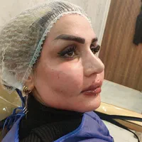 تزریق چربی ،فیلر بادی،عمل پلک،ژل و بوتاکس|خدمات آرایشگری و زیبایی|تهران, صادقیه|دیوار