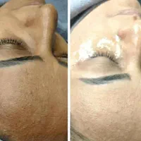 فیشال(پاکسازی) اقتصادی صورت vip|خدمات آرایشگری و زیبایی|محمدیه-قزوین, |دیوار