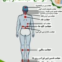 زالو درمانی و حجامت