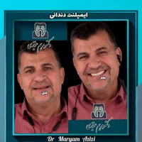 پایتخت ایمپلنت دندان دندانپزشکی تضمینی تعرفه دولتی|خدمات آرایشگری و زیبایی|شیراز, معالی‌آباد|دیوار