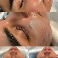 پاکسازی و فیشیال تخصصی و پلاژن تراپی ( فیشال )|خدمات آرایشگری و زیبایی|شیراز, شهرک قمشه|دیوار