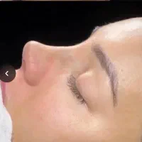 عمل جراحی زیبایی بینی پلک،گوش،اندام|خدمات زیبایی و سلامت|تهران, تهرانپارس غربی|دیوار