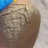 کاشت ناخن درمان ناخن کفسابی پارافینتراپی. اموزش|خدمات آرایشگری و زیبایی|مشهد, صیاد شیرازی|دیوار