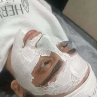 لیزر موهای زائد لیزر مو فشیال پاکسازی پوست|خدمات آرایشگری و زیبایی|تهران, فلسطین (میدان انقلاب)|دیوار