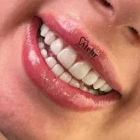 کامپوزیت هشت واحد فقط با ۵ تومان