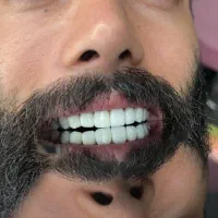 تخفیف خدمات کامپوزیت|خدمات آرایشگری و زیبایی|اهواز, زیتون کارمندی|دیوار