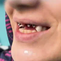 دندانپزشکی/ ایمپلنت دیجیتال با وام قرض الحسنه|خدمات آرایشگری و زیبایی|اصفهان, گلزار|دیوار