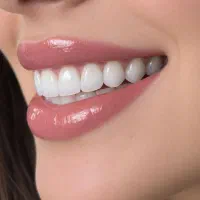 جشنواره خدمات دندانپزشکی با تخفیف های ویژه