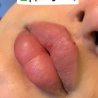 استخدام نیرواجاره ودرصدی صندلی زیبایی ماساژآریشگری|استخدام درمانی، زیبایی، بهداشتی|گرگان, |دیوار