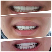 خدمات دندانپزشکی|خدمات آرایشگری و زیبایی|قم, عمار یاسر|دیوار