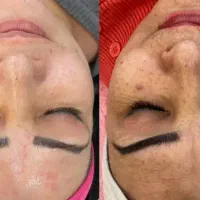 مدل برای فشیال و پاکسازی