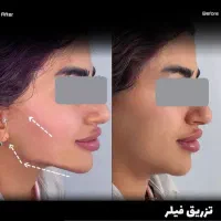اقساطی/کاشت مو تضمینی/کاشت ابرو/ژل لب|خدمات آرایشگری و زیبایی|سنندج, |دیوار