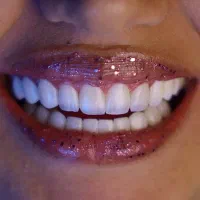 دندان پزشکی زیبایی و درمانی مروارید با شرایط اقساط