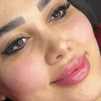 آموزش ژل و بوتاکس و مزو با 7تومن تا دوروز