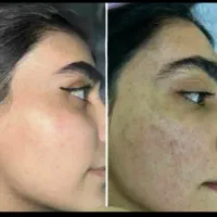 کرم روشن کننده صورت وبدن ضدلک(اماراتی)vip|آرایشی، بهداشتی، درمانی|اهواز, شریعتی جنوبی|دیوار