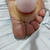 ماساژ ورگ گیری ،حجامت، دیسک ، ،زالو|خدمات آرایشگری و زیبایی|نیشابور, شهرک جانبازان|دیوار