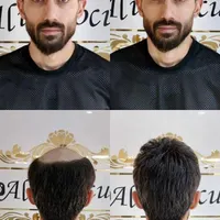 پروتزمو چسب ترمیم مو عمده و تک تهرانپارس تعویض چسب|خدمات آرایشگری و زیبایی|تهران, مهران (سیدخندان)|دیوار