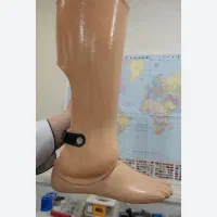 واگذاری پای مصنوعی