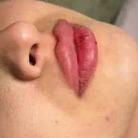 نیازمند مدل تزریق ژل|خدمات آرایشگری و زیبایی|ارومیه, |دیوار