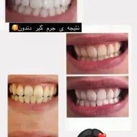 جرمگیر،اسانس میخک،خمیر دندان مسواک عطاری آقای عطار|آرایشی، بهداشتی، درمانی|زنجان, |دیوار