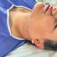 لیپو ساکشن غبغب۶۹۰۰ تخلیه چربی شکم و پهلو ۱۹میلیون|خدمات آرایشگری و زیبایی|اصفهان, احمدآباد|دیوار