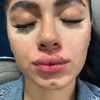 ژل لب|خدمات آرایشگری و زیبایی|شیروان (خراسان), |دیوار