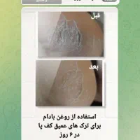 نمایندگی روغنهای درمانی وخوراکی|آرایشی، بهداشتی، درمانی|فریمان, |دیوار