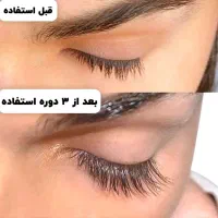 تقویت مژه|آرایشی، بهداشتی، درمانی|تهران, زرکش|دیوار