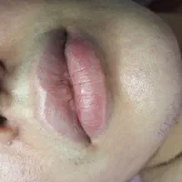 لیزر والکترولیز|خدمات آرایشگری و زیبایی|شیراز, شاه قلی بیگی|دیوار