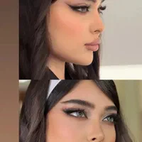 تخفیف عمل جراحی بینی لیفت لیپو ابدو کاشت ابرو مو|خدمات آرایشگری و زیبایی|کرج, عظیمیه|دیوار