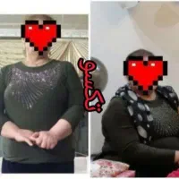 طبیعی و بدون بازگشت بدنتو پر و خوش اندام کن|آرایشی، بهداشتی، درمانی|سبزوار, دانشگاه آزاد|دیوار