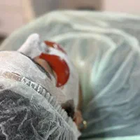 خدمات فیشال و پاکسازی پوست