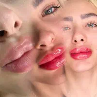 اموزش میکروبلیدیگ