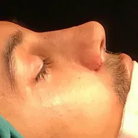 خدمات عمل جراحی زیبایی بینی و ترمیم بینی|خدمات آرایشگری و زیبایی|تهران, فلاح|دیوار