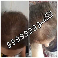 موهای بلند پرپشت داشته باشید|آرایشی، بهداشتی، درمانی|رشت, آزادگان|دیوار