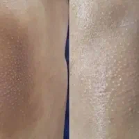 آموزش فیشال مبتدی و پیشرفته|خدمات آموزشی|آبادان, |دیوار