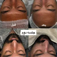 تخفیف آموزش و خدمات فیشال تخصصی بانوان و آقایان|خدمات آرایشگری و زیبایی|مشهد, کوثر|دیوار