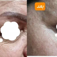 روغن های ترکیبی|آرایشی، بهداشتی، درمانی|تهران, شهرک گلها|دیوار