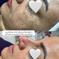 فیشال و پاکسازی صورت|خدمات آرایشگری و زیبایی|شیراز, شهرک فرزانگان|دیوار