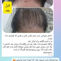 با تونیک ضدریزش آریا موهای ریختتو برگردون|آرایشی، بهداشتی، درمانی|کرمان, |دیوار