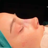 عمل جراحی زیبایی بینی،پلک،لیفت صورت،اندام|خدمات زیبایی و سلامت|تهران, نیروی هوایی (پیروزی)|دیوار