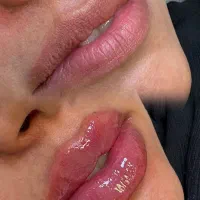 مرکز لیزر و زیبایی الماس.اندولیفت.بوتاکس.ژل لاغری|خدمات آرایشگری و زیبایی|اصفهان, شاهزید|دیوار