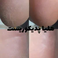 تخصصی ترین کفسابی باهلیا