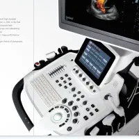 سونوگرافی رنگی sonoscape|پزشکی|تهران, دریا|دیوار