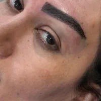 کاشت ابرو