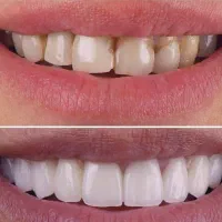 خدمات دندانپزشکی با اقساط ۱۲ ماهه