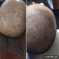 نانووگان نقره نرم کننده وترمیم کننده|آرایشی، بهداشتی، درمانی|مرودشت, فاز دوم شهرک فرهنگیان|دیوار