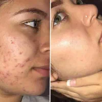 روغن های معجزه گر درمان تمام مشکلات پوست و مو|آرایشی، بهداشتی، درمانی|اندیمشک, |دیوار