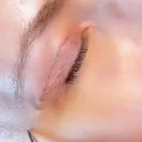 بلفاروبلاستی( جراحی پلک بدون رد بخیه)|خدمات آرایشگری و زیبایی|یاسوج, |دیوار