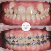 ارتودنسی تخصصی کاملا اقساطی